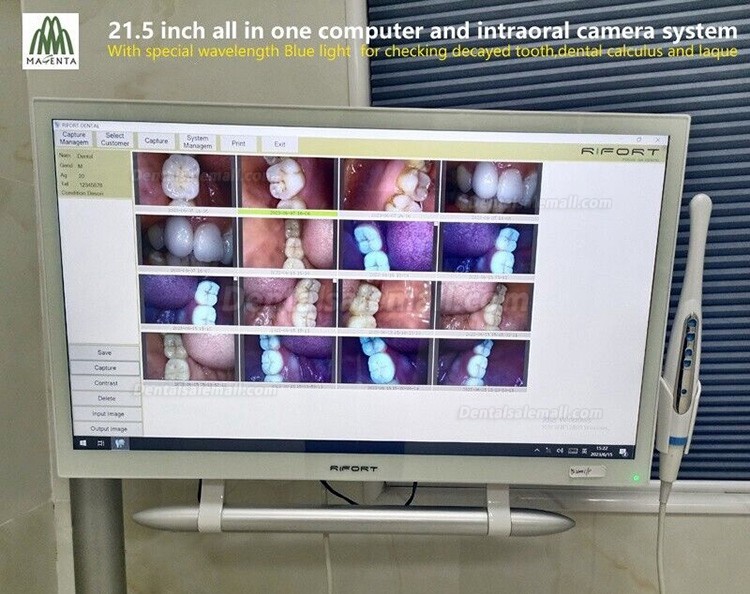 Magenta YF-2200P+ 21.5 Inch LCD Monitor Touch Screen Intraoral Camera VGA+HDMI